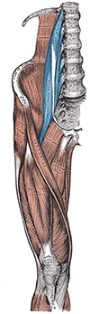 Psoas abscess diagram