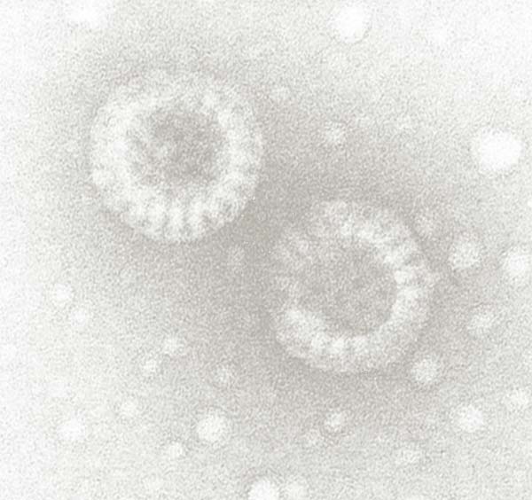 rotavirus