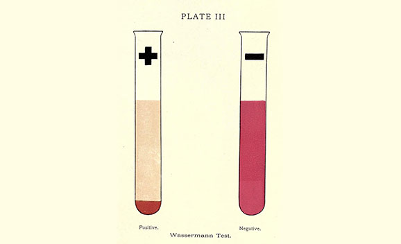 Wassermann Test, old image