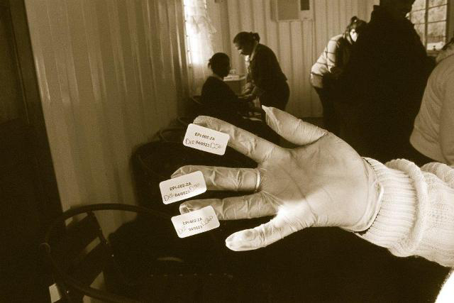 Biomarker discovery offers hope for new TB vaccine