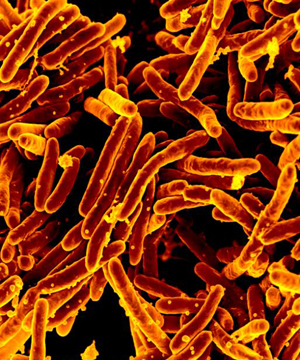Latest transmission patterns for drug resistant TB pose a new challenge