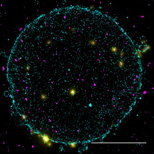 Super Resolution image of CD4 clusters at the surface of a lymphocyte (cyan), and bound HIV particles (Immunolabelled HIV p17, magenta [SR] and yellow [Diffraction-limited TIRF]) Credit: Caron Jacobs