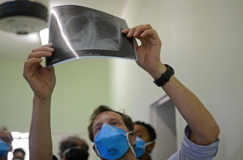 Image of doctor holding up an x-ray