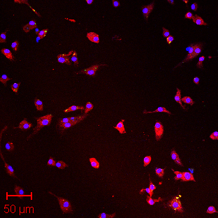 Macrophages infected with Mycobacterium tuberculosis