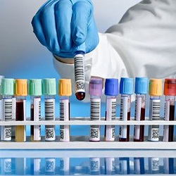 Image of test-tubes in a rack