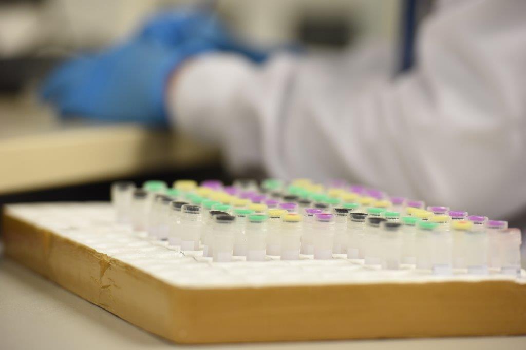 A blood RNA signature for tuberculosis disease risk: a prospective cohort study