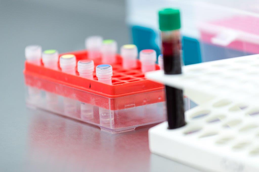 Biomarker-guided tuberculosis preventive therapy (CORTIS): a randomised controlled trial