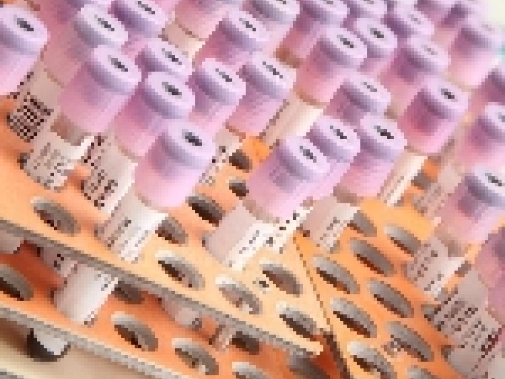 Image of vacutainer tubes in a rack; supplied by Pixabay