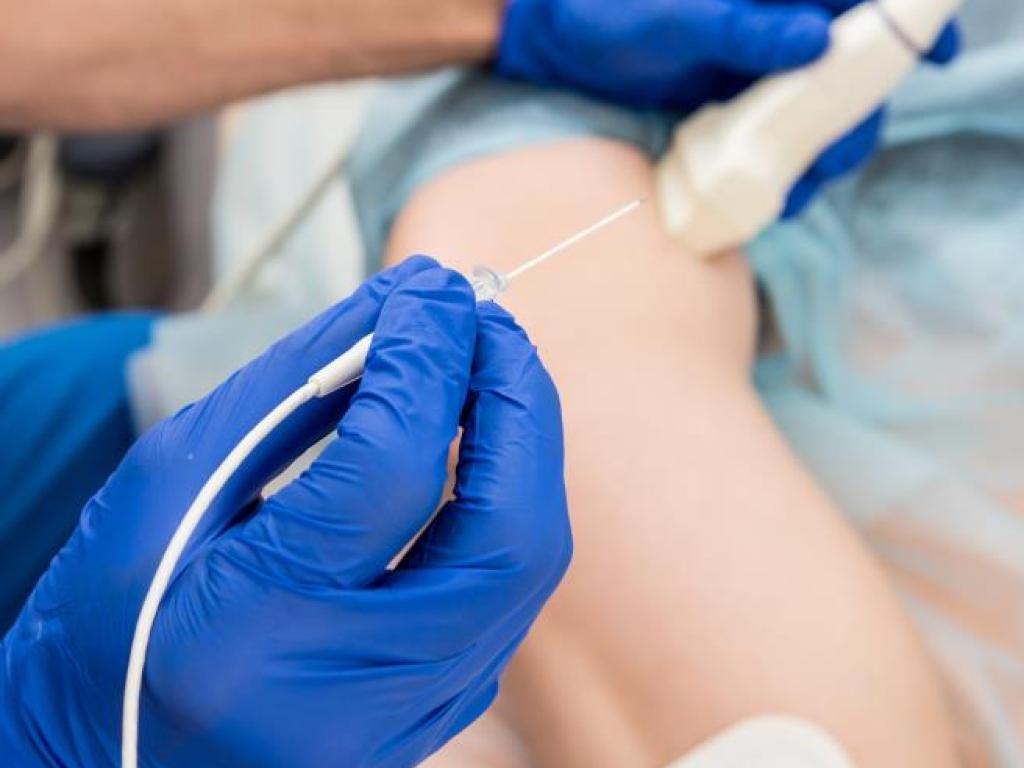 Ultrasound Guided Vascular Access