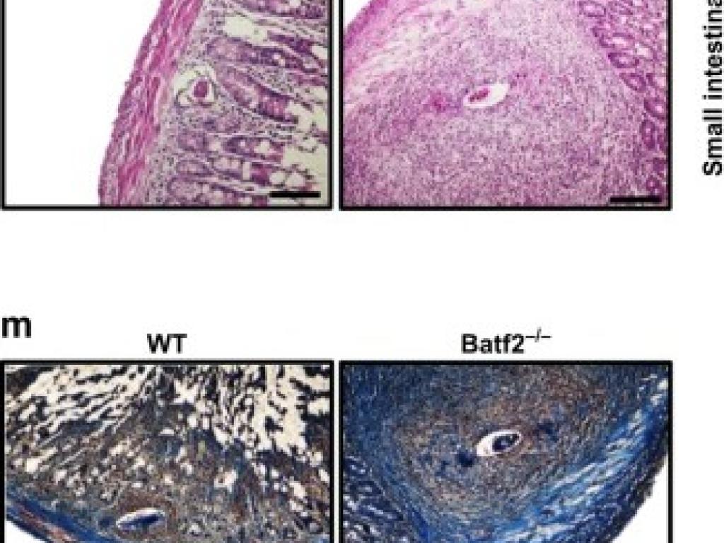 Batf2 differentially regulates tissue immunopathology in Type 1 and Type 2 diseases