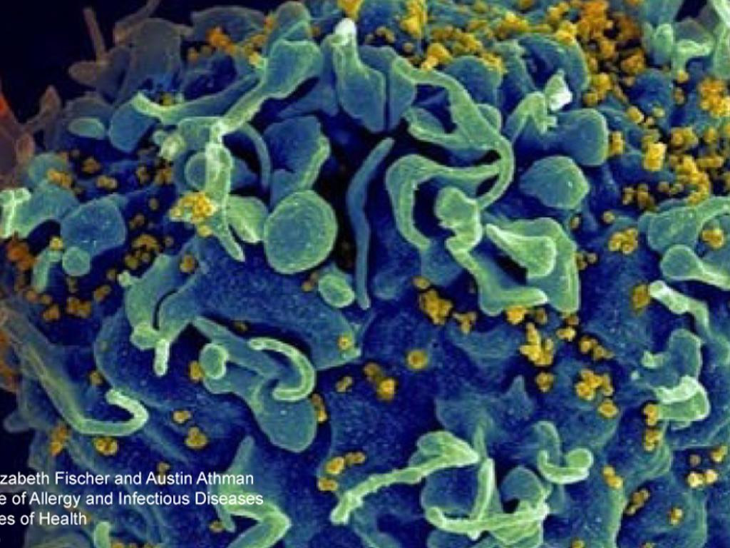 hiv