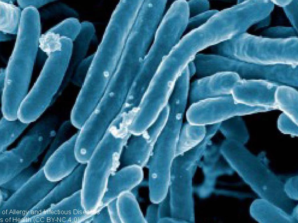 m._tuberculosis-