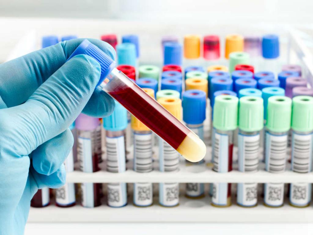 Serial QuantiFERON testing